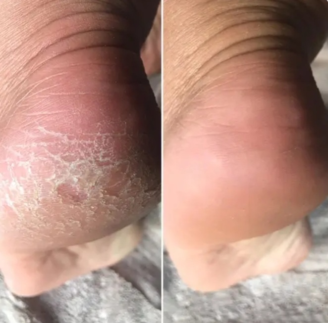 Antes e depois 5