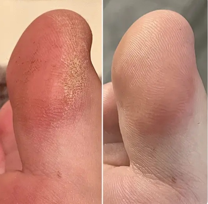 Antes e depois 4