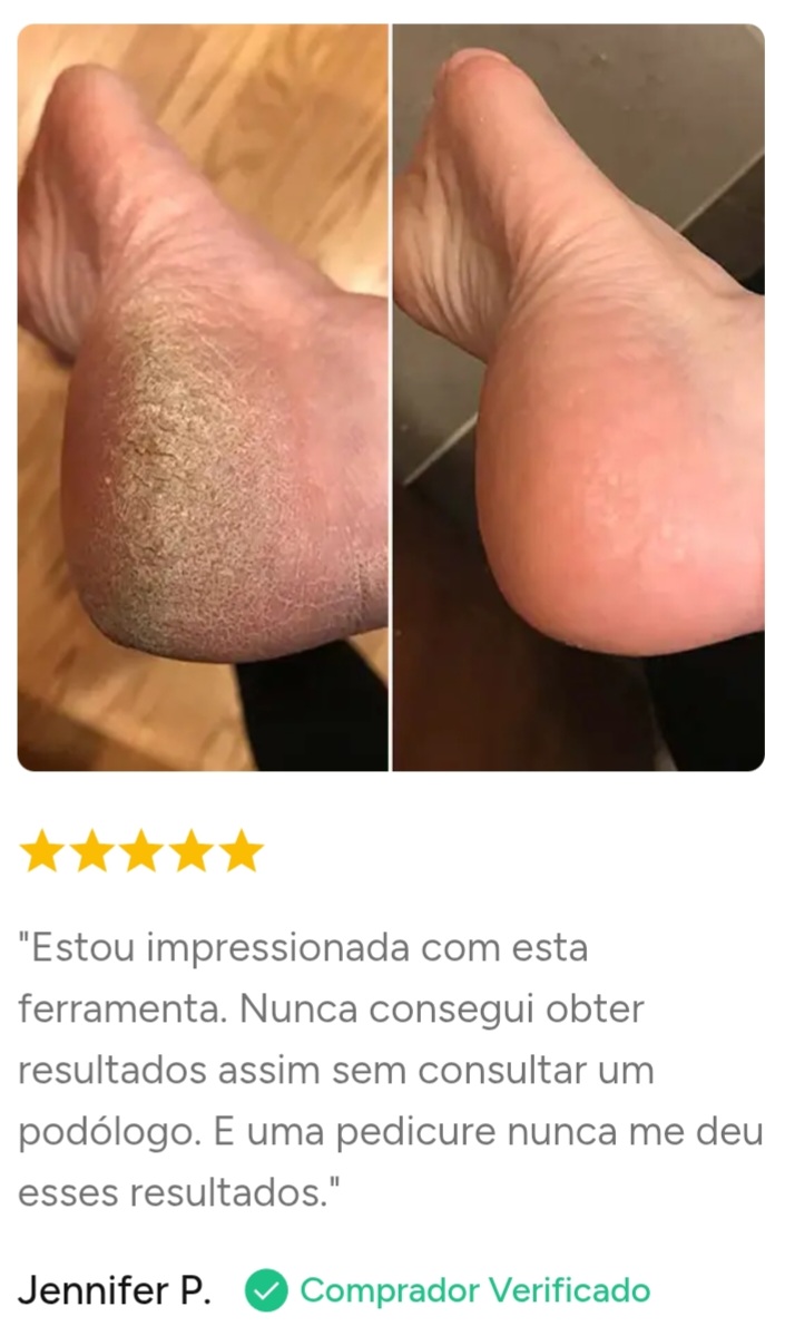 Depoimento de cliente 5