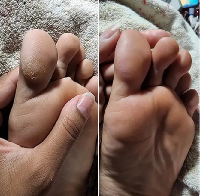 Antes e depois 6