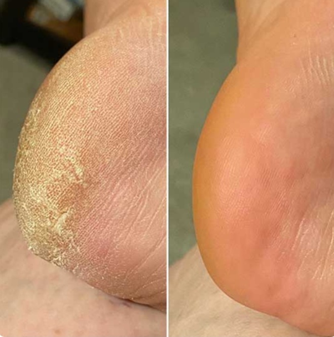 Antes e depois 7